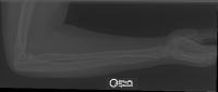 pkd project thumbnail