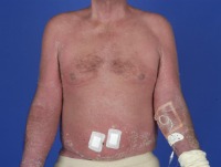Skin diseases. project thumbnail