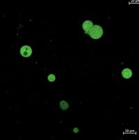 vesicles-ipt-cal project thumbnail