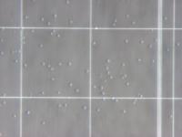 cell-counting project thumbnail