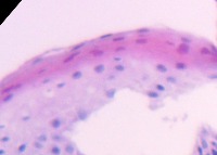 histo project thumbnail