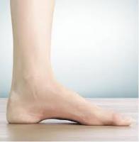 Foot Image Classification. project thumbnail