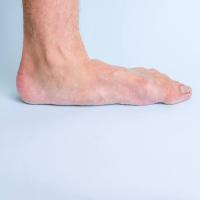 Foot Image Classification. project thumbnail