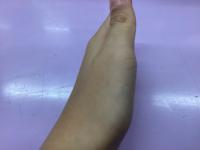 Hand Detet project thumbnail