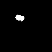 Brain tumor project thumbnail