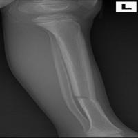 Fracture detection project thumbnail