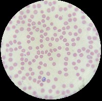 Parasite dataset project thumbnail