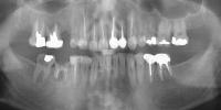 panoramic-radiography-apico-combined-apical 8.3gb 2 project thumbnail
