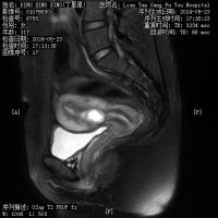 Medical object detection project thumbnail