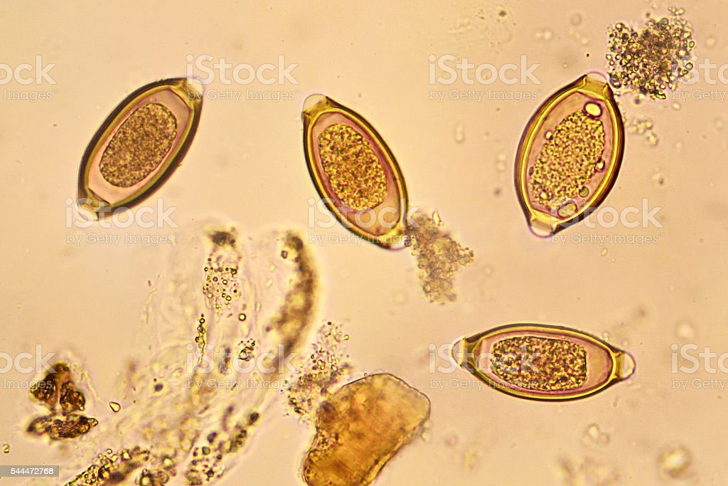 Helminth-eggs Object Detection Model by ROBOTICS WORK