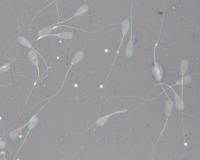 Spermatozoi project thumbnail