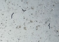 Worm-Pose-Detector project thumbnail