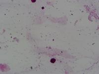 ColonyCount project thumbnail