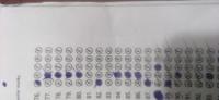 bubles detection project thumbnail