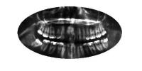 dentalai-i4clz-ss-dawl project thumbnail
