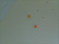 Pill Detection project thumbnail