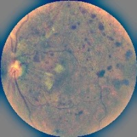 Dataset Image