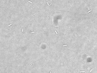 E. coli Shapes project thumbnail