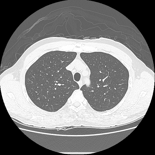 Lung Class Object Detection Dataset By Project 7hmcb lung-class-object-detection-dataset-by-project-7hmcb
