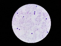 DETECCION MALARIA project thumbnail