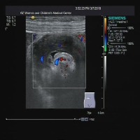 AbdomenMRI project thumbnail