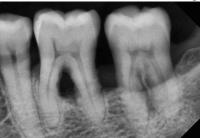 30_PA_bone project thumbnail