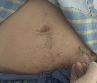 insulin project thumbnail