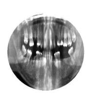 without augmentation project thumbnail