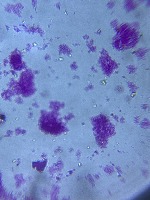 Coli Smear project thumbnail