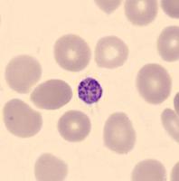 Blood cell detection project thumbnail