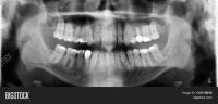Find infections and carris project thumbnail