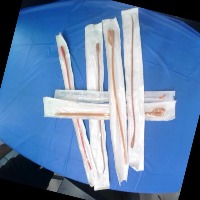 catheter_us_5_Oct 2 project thumbnail