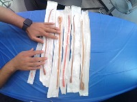catheter_us_5_Oct project thumbnail