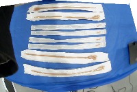 catheter_us_18_Oct 1 project thumbnail