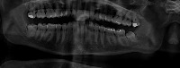 Winters classification project thumbnail