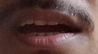 crop_teeth project thumbnail