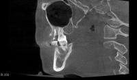 332sagittal project thumbnail