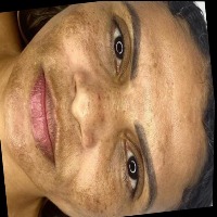 skin_issues project thumbnail
