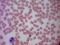 blood smear-contour tolerance 10 project thumbnail