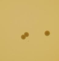 Bacteria colony counting project thumbnail