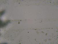 microscope sperm project thumbnail