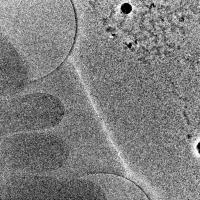 ultra_low_dose_bacteria_thickness project thumbnail