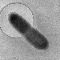 bacteria-thickness project thumbnail