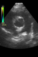 VSD Detection project thumbnail