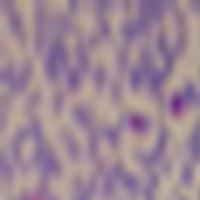 blood cell detection project thumbnail