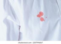 stain detection project thumbnail
