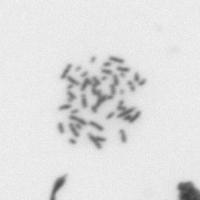 chromosome 10x project thumbnail