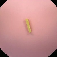 32556 project thumbnail
