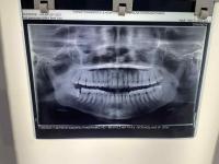 Teeth project thumbnail