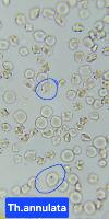 Morphological changes project thumbnail